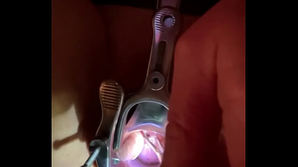insertion of sound tenaculum into cervix